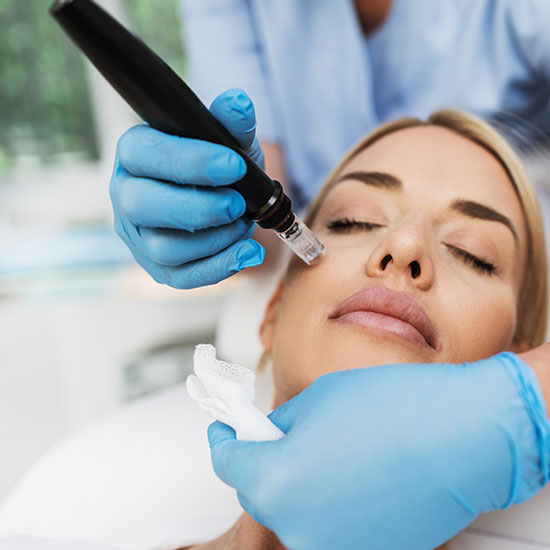 Microneedling